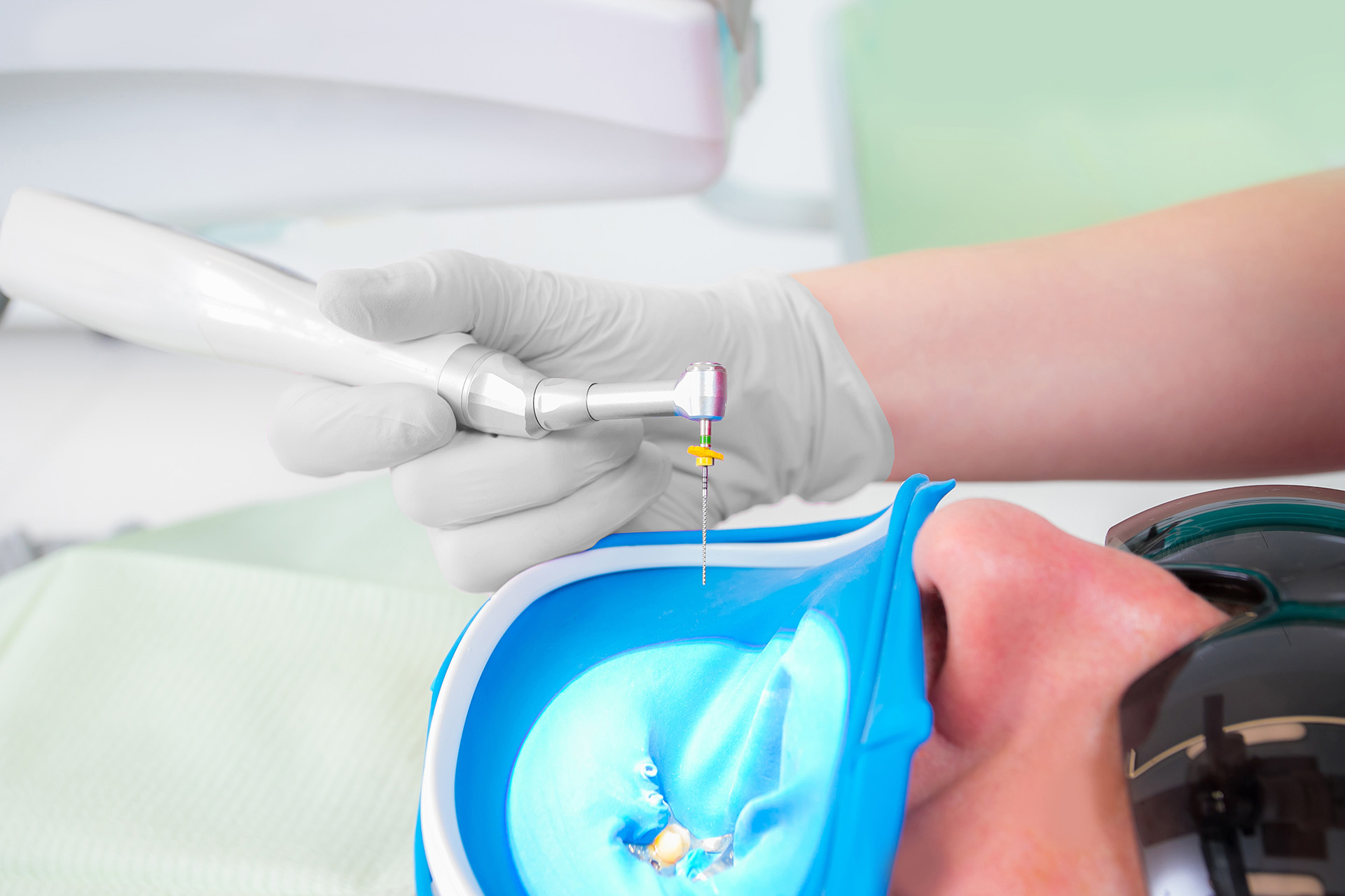 Endodonzia moderna con strumenti rotanti in NiTi, Perugia