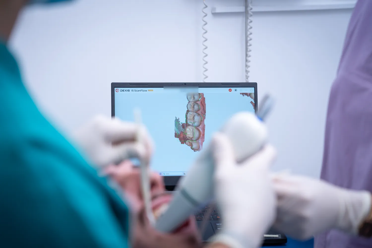 Scansione intraorale 3D per protesi dentale, Perugia