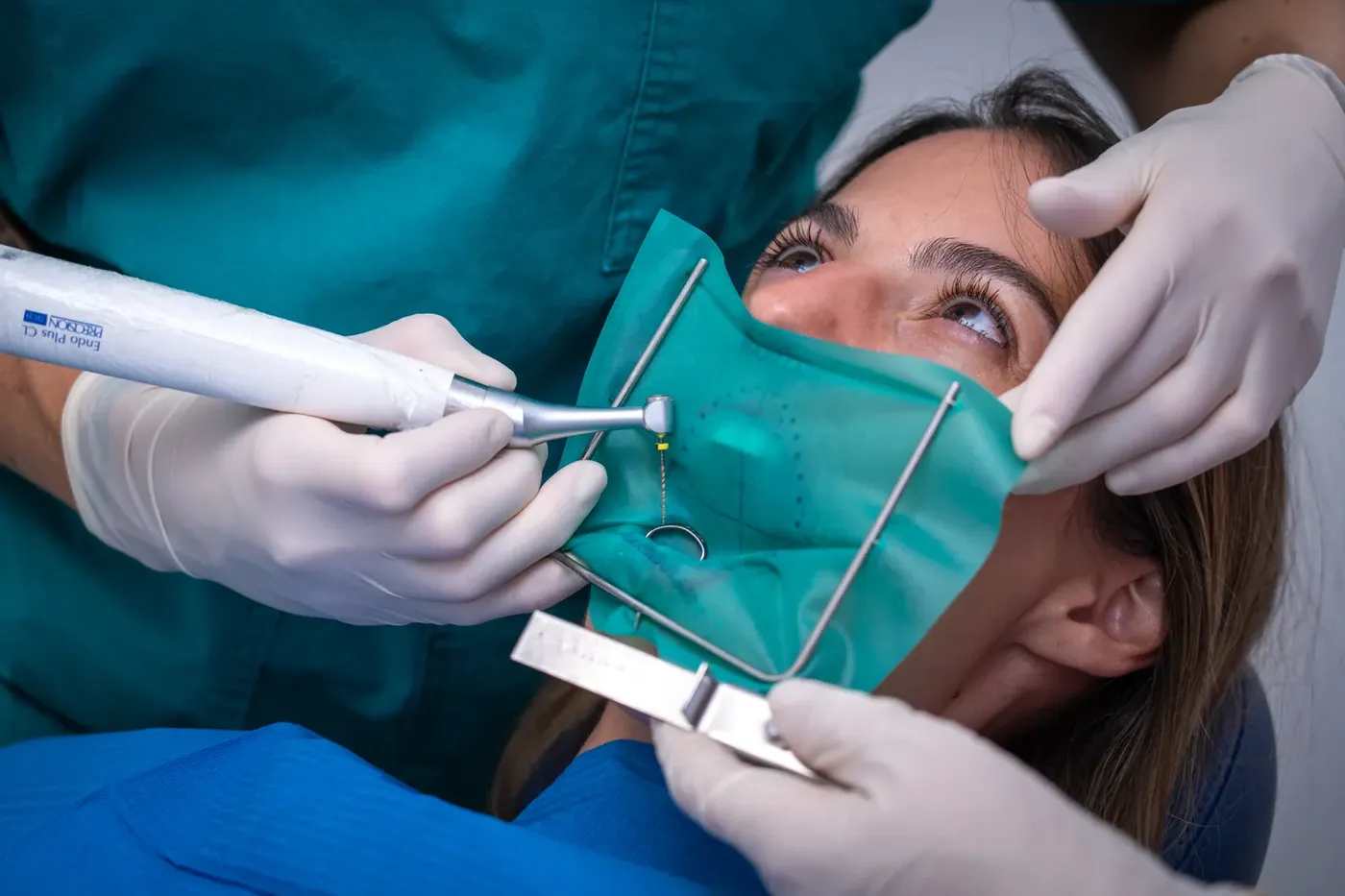Endodonzia moderna con strumenti rotanti in NiTi, Perugia